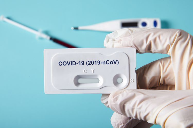 Jubir Covid-19 Kaltara: Alat PCR Bisa Dibeli, Cuma Banyak Persyaratannya